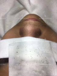 -苑苑vbeauty科技美容SPA