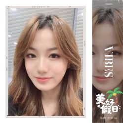 -大麦微针植发全国连锁