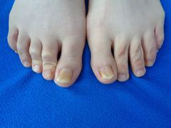 -世龙世家甲沟炎·灰指甲·嵌甲矫正·修脚(武侯区双楠店)