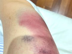 -Dragonfly悠庭·按摩Spa(静安嘉里中心店)