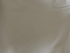 枕头上不明虫体-鹤壁迎宾馆