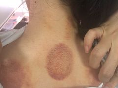 -大唐盲人按摩中心(黄山路店)