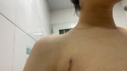 体验后-深圳阳光医疗美容医院·旗舰店