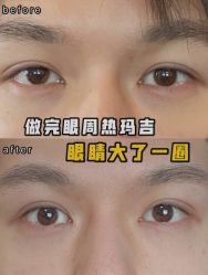 -上海漾颜医疗美容