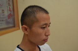 -大麦微针植发丨全国连锁