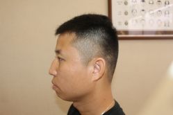 -大麦微针植发丨全国连锁