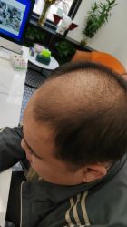 -唐风采假发补发定制