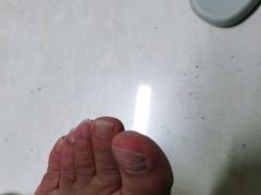 -新甲连锁灰指甲·甲沟炎·鸡眼(黑龙江路店)