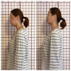 -FACE·日本小颜矫正美容整骨サロン