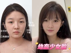 -Yestar重庆艺星医疗美容医院