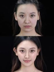-南京美莱医疗美容·旗舰店