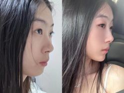 -Yestar 嘉兴艺星医疗美容医院