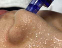 -韩国淼美颜皮肤管理官方直营店