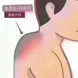 -涌泉妈咪树通乳·产后恢复