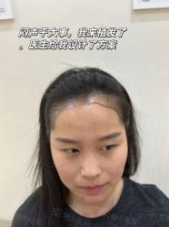 -雍禾植发全国连锁