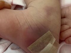 -天津市第三中心医院