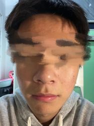 -元熙兰积皮肤管理