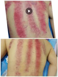 -清媚减肥瘦身纤体