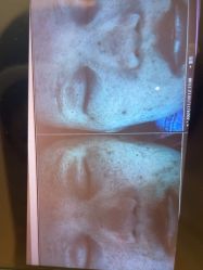-苑苑vbeauty科技美容SPA