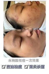 -E.beauty驻颜·痘敏肌调理中心
