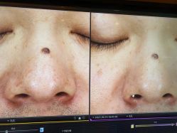 -苑苑vbeauty科技美容SPA