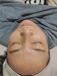 -苗老祖痘敏斑激素脸问题皮肤修复中心