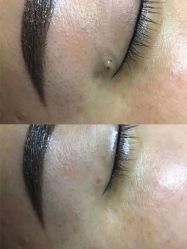 -悦己医疗美容整形线雕提升专门店