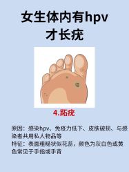 -美丽人生祛斑扁平疣汗管瘤中心