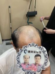 -唐风采假发补发定制