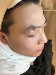 -友仟痘医生科学祛痘连锁