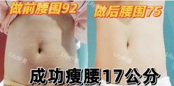 -Lily纤美·科技减脂中心