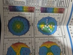 -美尔目眼科医院·近视手术·儿童近视(通州店)