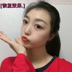 点击看大图 -新生植发·植养护一体