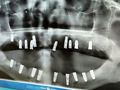 -佛山中大口腔医院·市二级口腔专科医院