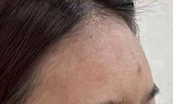 -天津健丽·去眼袋医疗美容机构