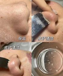 点击看大图 -阅年轻·AI家庭健康体质调理