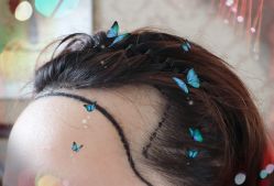 -大麦微针植发全国连锁