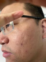-美人痣全国连锁