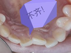 -上海仁爱医院口腔科 · 种植