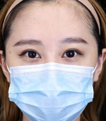 点击看大图 -丰联丽格医疗美容·联合丽格眼整形中心