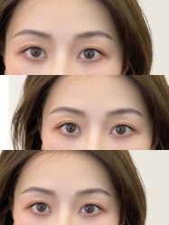 点击看大图 -杨益美学·野生眉半永久纹眉发际线