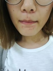 -成都军建医院·疤痕诊疗中心