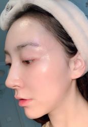 体验后-一美医疗美容