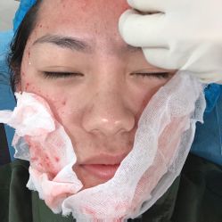 -天津健丽·去眼袋医疗美容机构