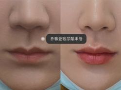 -上海漾颜医疗美容