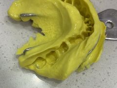 -上海仁爱医院口腔科 · 种植