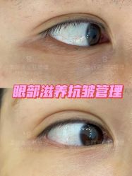 -MLP美丽派·问题肌疗愈中心