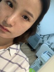 体验后-JUVA欧华医美连锁