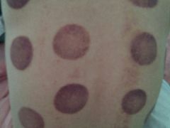 -益友堂盲人推拿正骨穴位按摩工作室