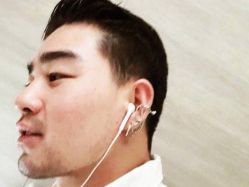 体验后-北京米扬丽格医疗美容·联合丽格鼻整形中心